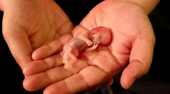 Reino Unido concede licença de luto após aborto e levanta questão: se há luto, houve assassinato?